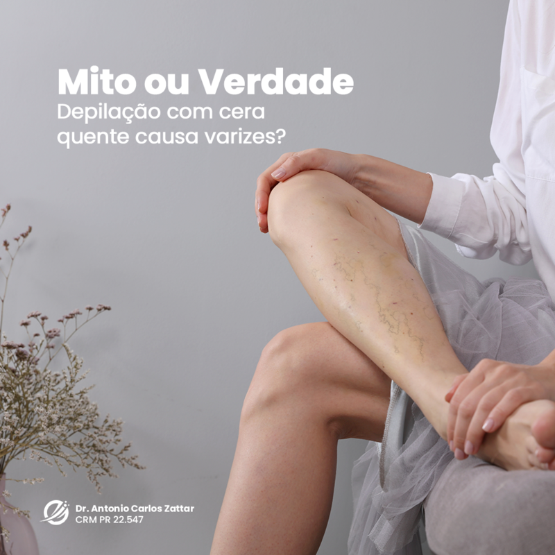 Depilação com cera dá varizes?